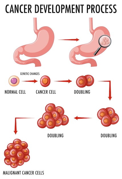 The Role of Infectious Agents in Cancer Development